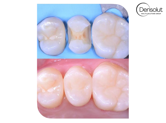 DENSOLUT, Health Solutions Group