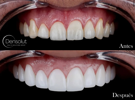 DENSOLUT, Health Solutions Group